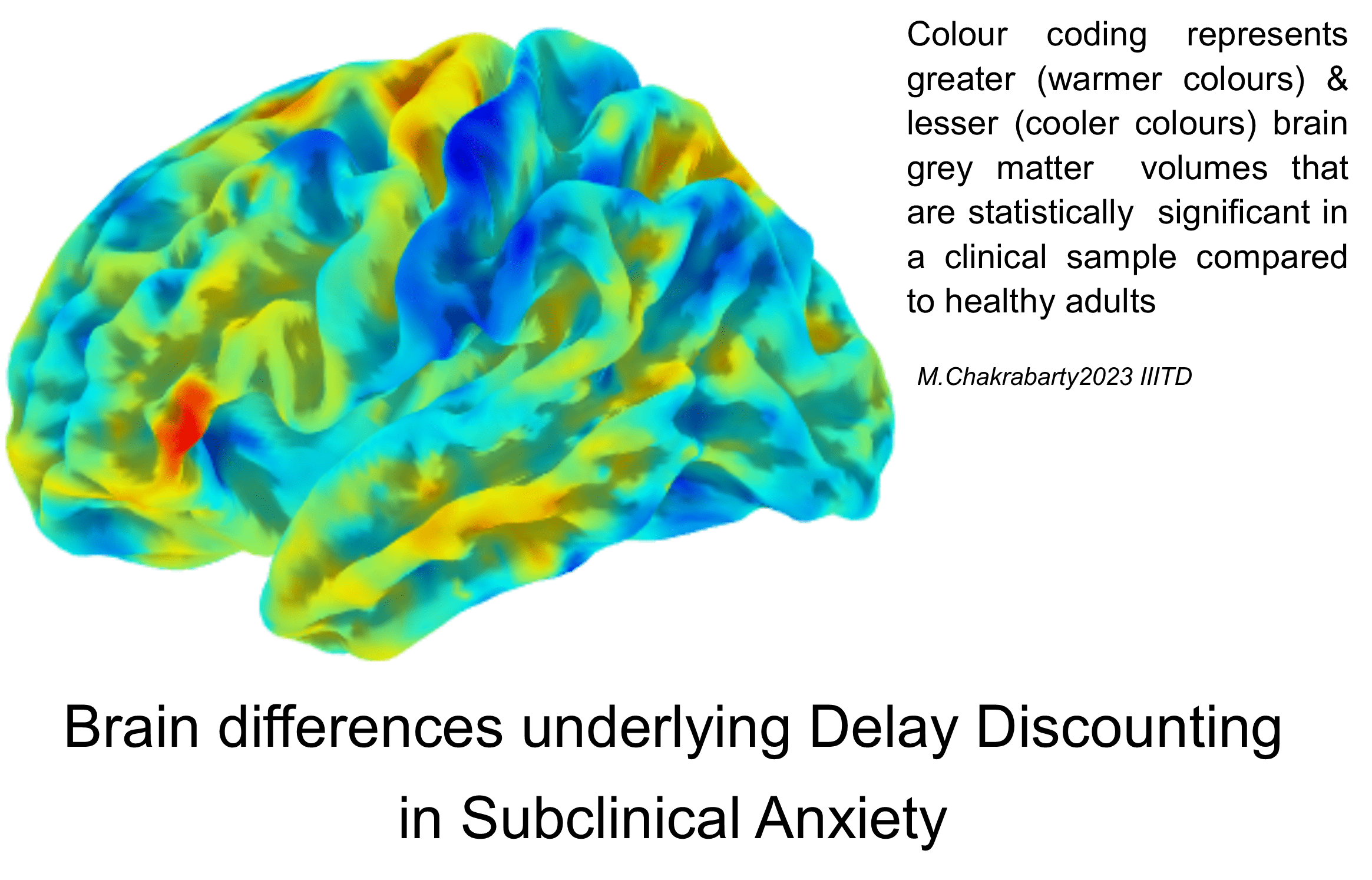 Brain Differences Underlying Delay Discounting in Subclinical Anxiety
